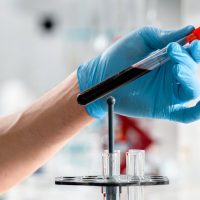 Analize vitamina D pentru sanatatea oaselor